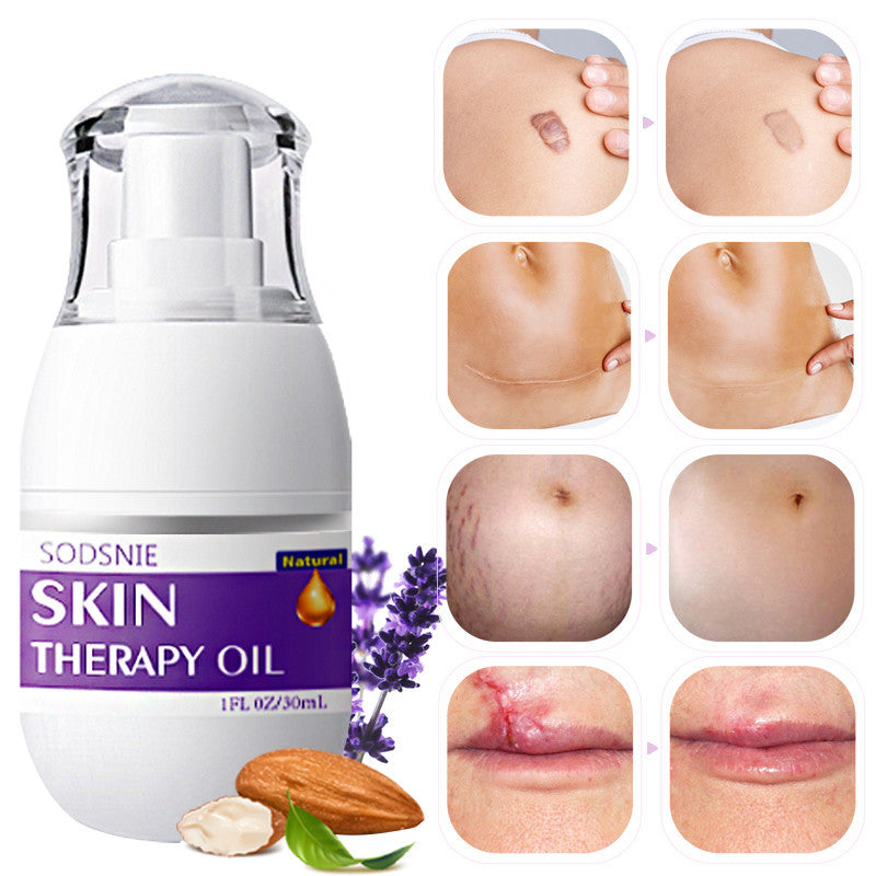Skin Treatment Oil Remove Puncture Cellulite Stretch Mark Repair Body Care 30ml Skin Treatment Oil Remove Puncture Cellulite Stretch Mark Repair Body Care 30ml
